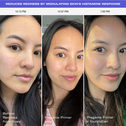 Best makeup primer for redness reduction